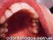 Odontología general-prótesis e implantes dentales