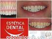 Blanqueamiento - Estética Dental Córdoba