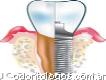 Laboratorio dental Integral