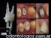 Urgencias Odontologias En Mar Del Platate 5492235447309