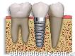 Odontólogo Ortodoncia Implantes
