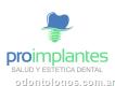 Pro Implantes - Especialidad en implantes dentales