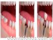 Implantes Dentales Córdoba 351-4240138