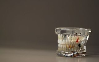 Odontología Integral - Dr Óscar a Limo